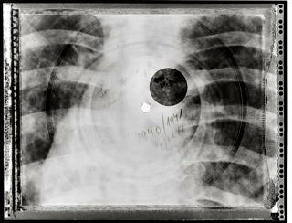 Illustration for article titled Soviet-era bootleg recordings made on discarded X-ray plates